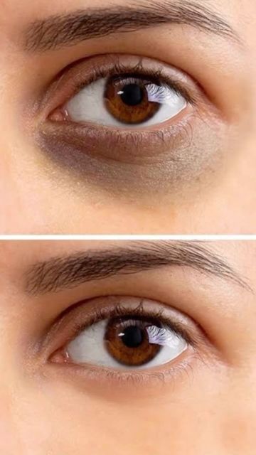Concealer Skin Super Multi-tasking Formula