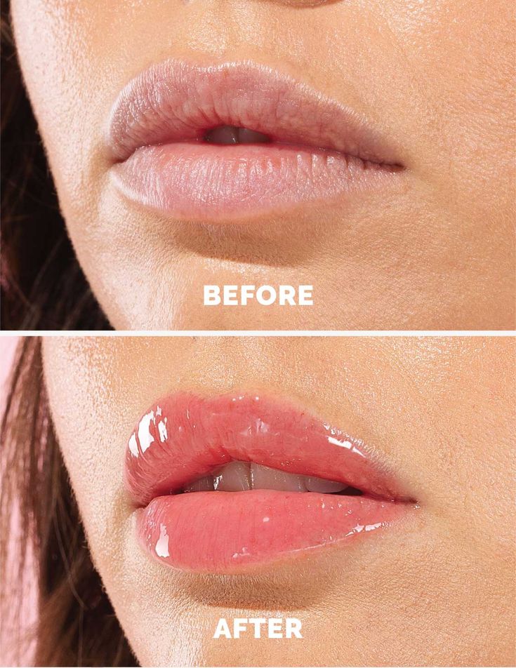 Hydra Kiss Lip Oil